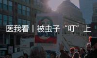 医我看丨被虫子“叮”上 ，发现“高烧和焦痂”�？别大意，这样急救�！