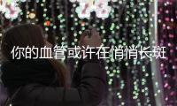 你的血管或许在悄悄长斑！这样做，“斑块”可能缩小→