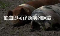 抽血即可诊断前列腺癌，拜登为何不测？