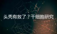 头秃有救了？干细胞研究阐明压力如何影响毛发生长