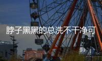 脖子黑黑的总洗不干净可能是病了	，这些疾病信号赶紧自查
